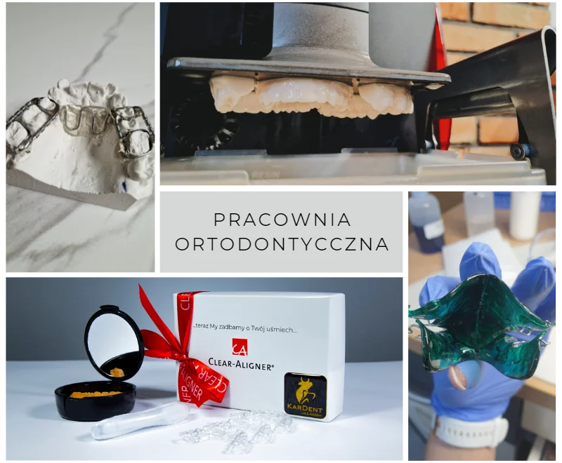pracownia ortodontyczna poznan- GMD, Clear Aligner,Płytka Schwarza